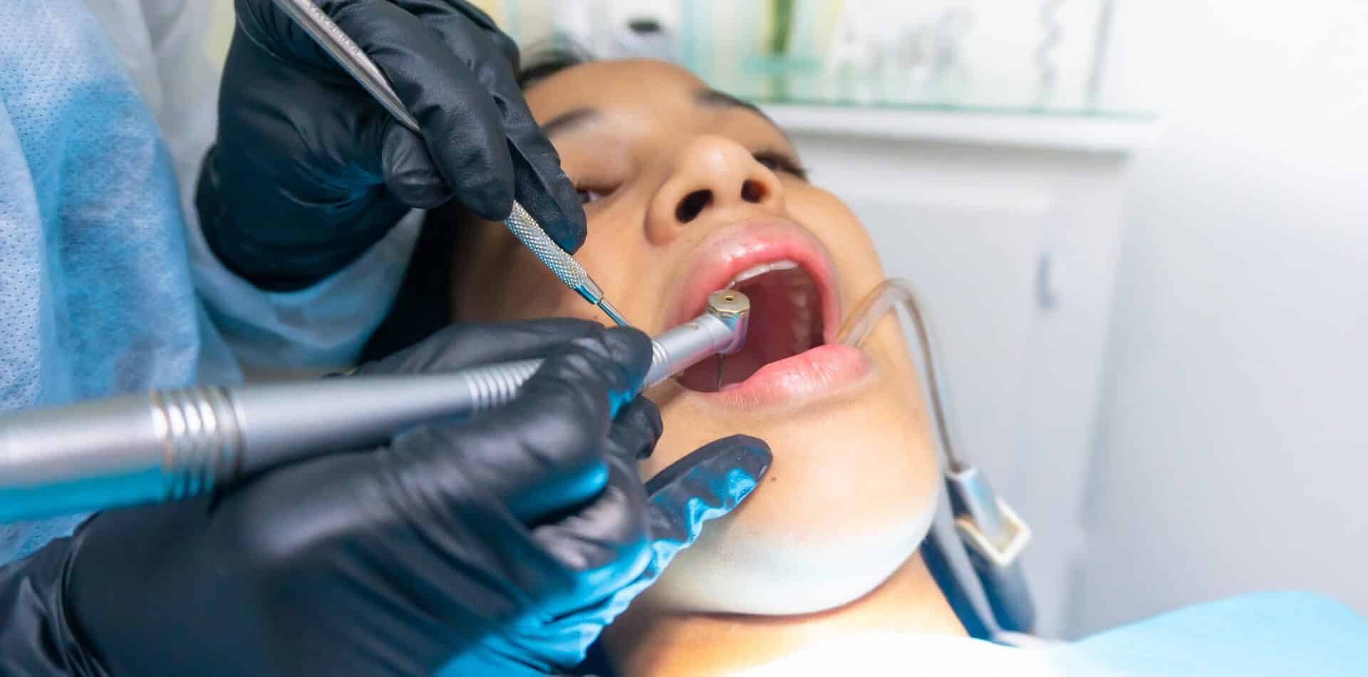 Still sensitive after a dental filling in Kalyan? Visit Redefine dental clinic Kalyan west