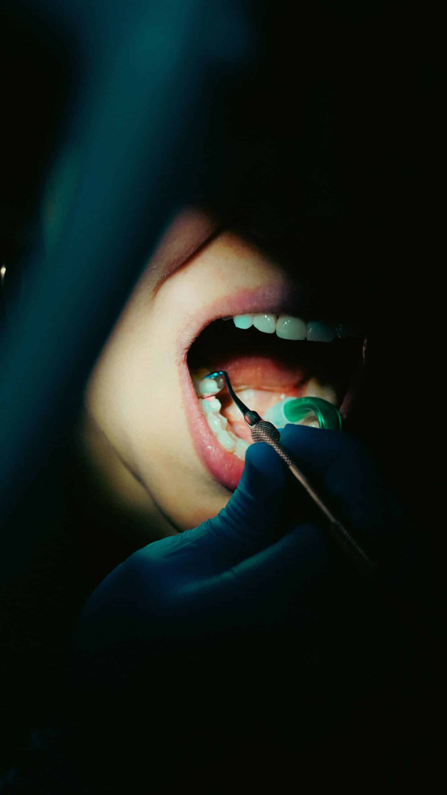 microscope root canal single sitting Kalyan West